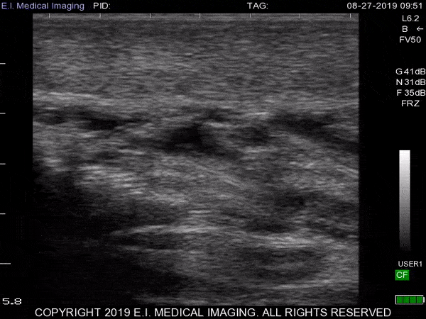 Ultrasound footage on a pregnant soupfin shark, showing two embryos. Credit: Andy Nosal